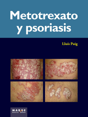 cover image of Metotrexato y psoriasis